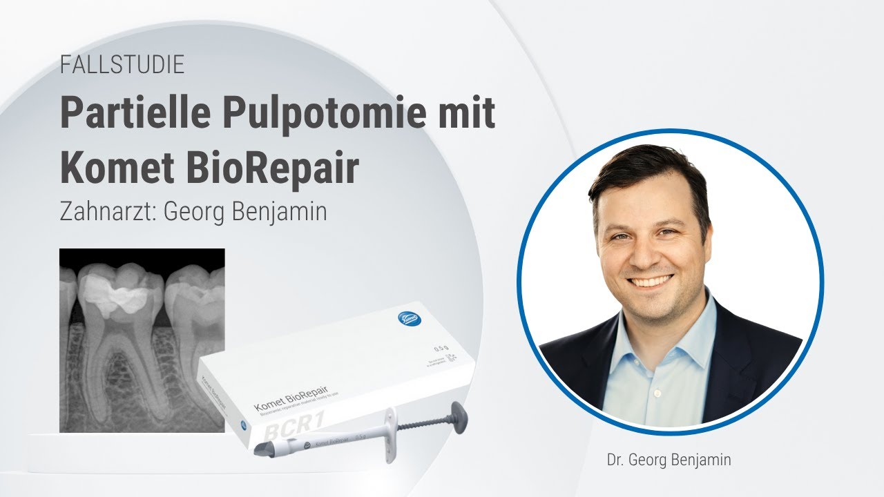 Partielle Pulpotomie mit Komet BioRepair von Zahnarzt Dr. Georg Benjamin