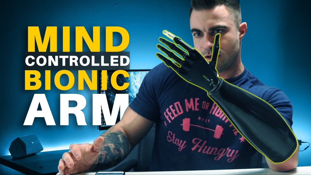 Mind-Controlled Bionic Arm w/iPhone App | How My Prosthetic Arm Works