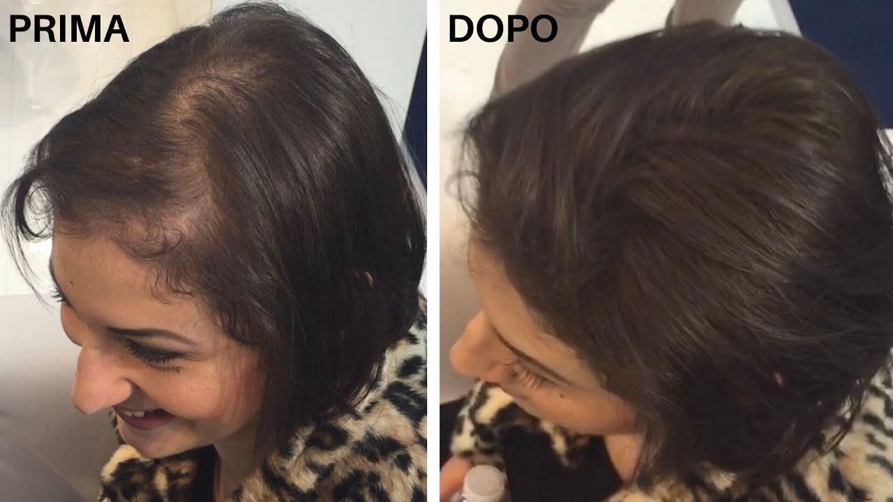 TOPPIK donna