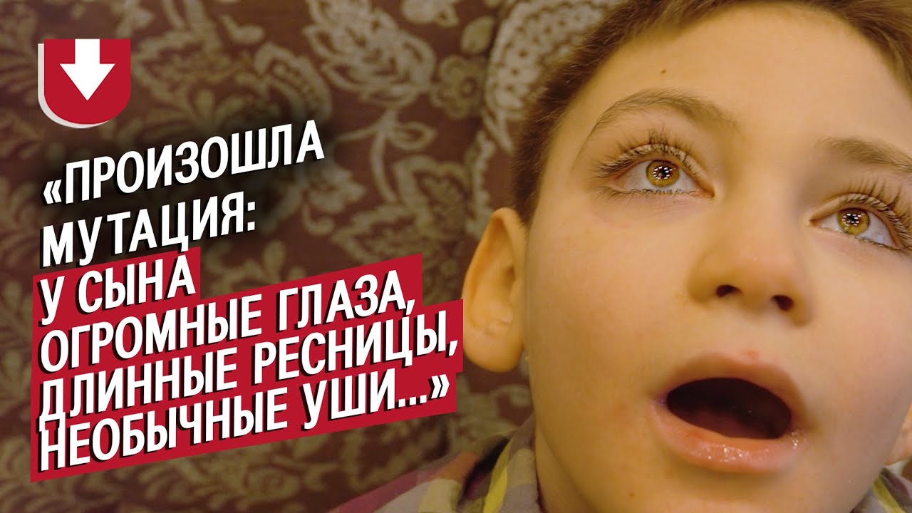 У моего сына синдром Кабуки: Лилия | Быть мамой