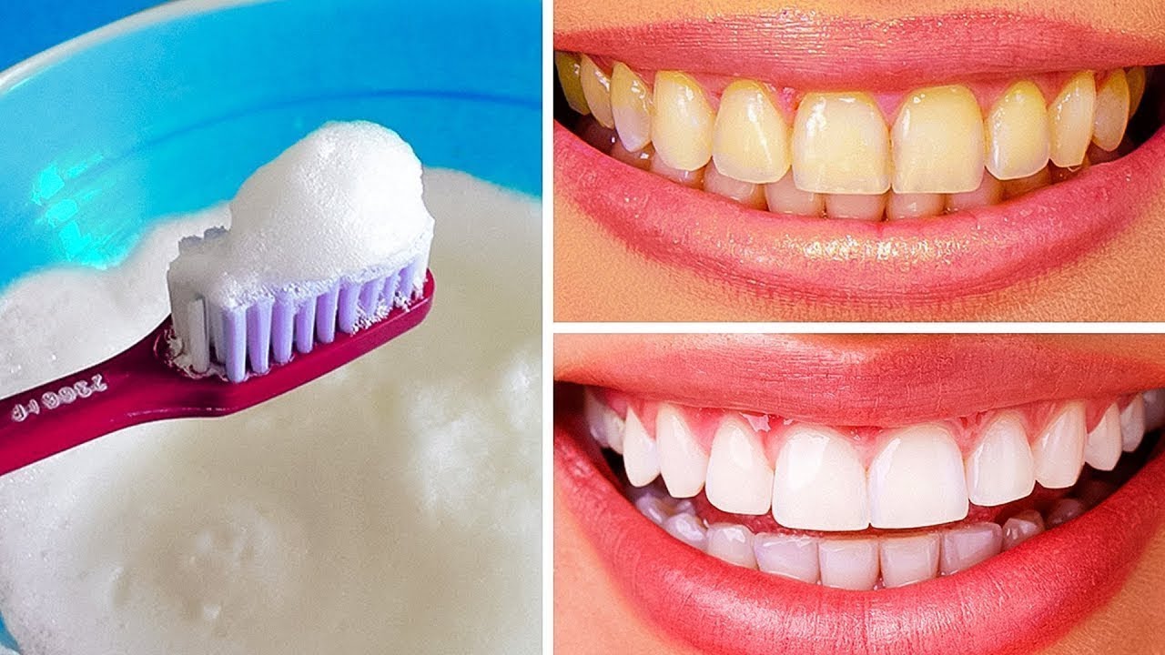 10 Maneiras Naturais de Clarear seus Dentes em Casa