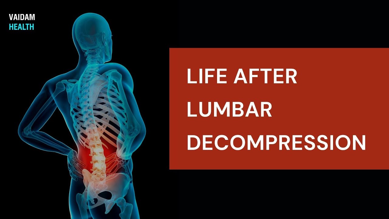 Life After Lumbar Decompression