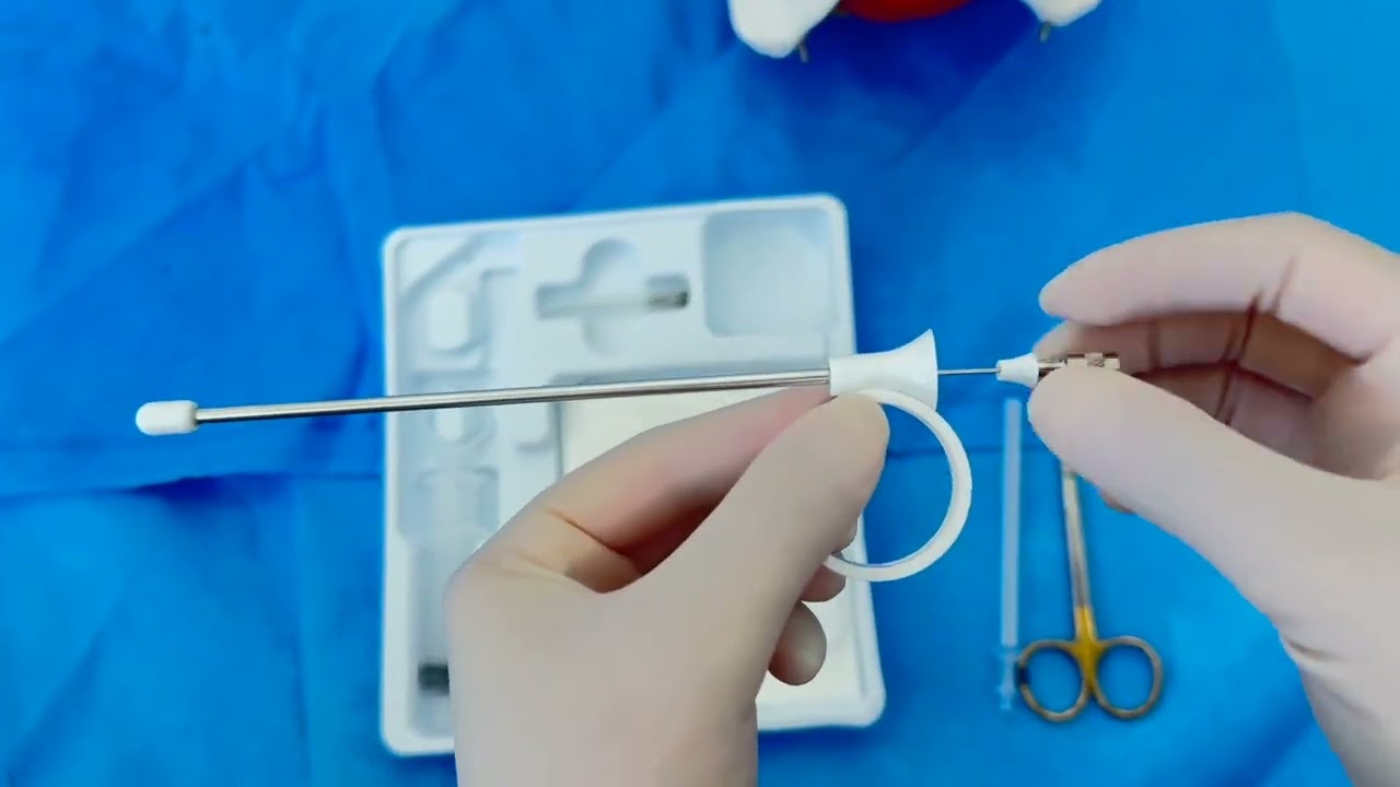 Pelvic floor trigger point injections in managing myofascial pelvic pain