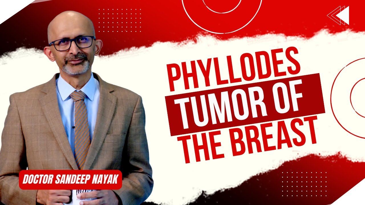 Phyllodes Tumor of the Breast | Dr. Sandeep Nayak | MACS Clinic
