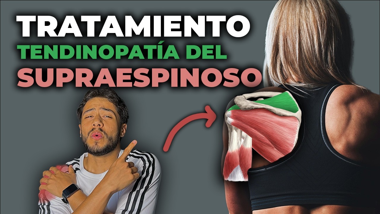Tendinitis del Supraespinoso: causas, ejercicios, tratamiento y errores más comunes - Guía Completa