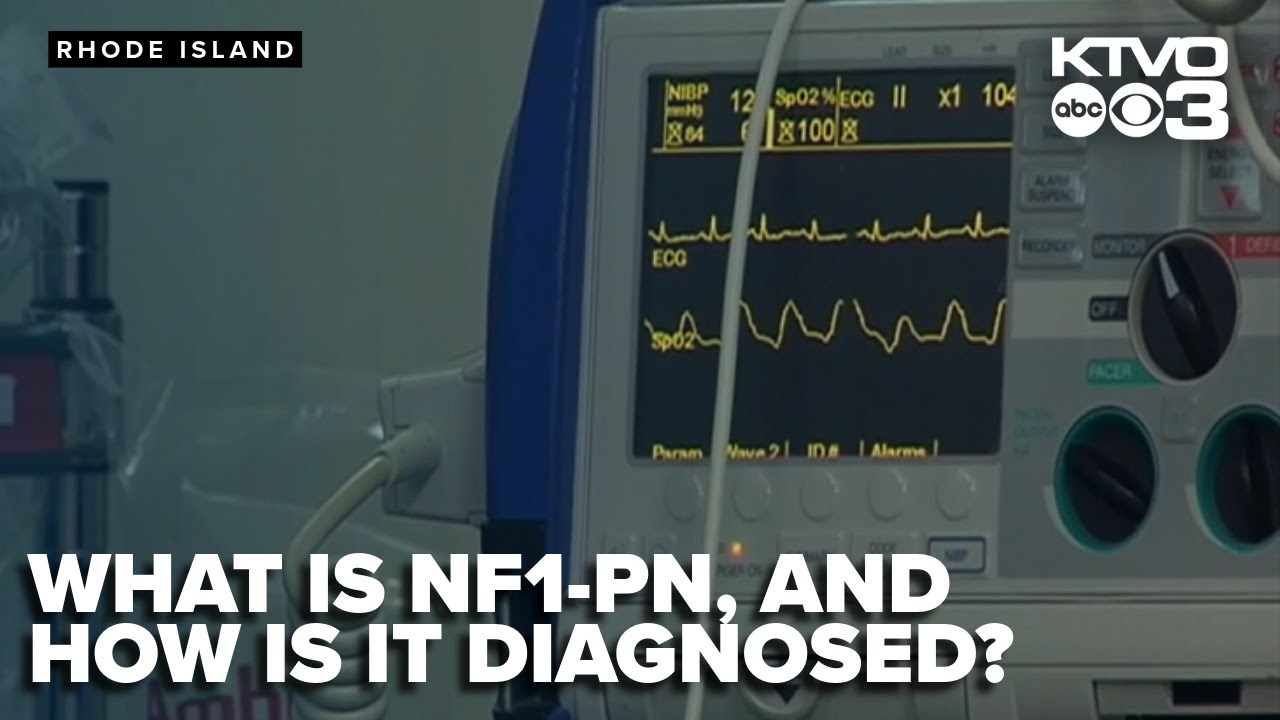 What is NF1-PN, and how can it be diagnosed?