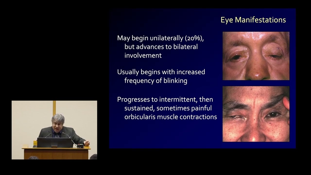 Facial Movement Disorders from the Perspective of the Oculofacial Specialist - Jonathon Dutton, MD