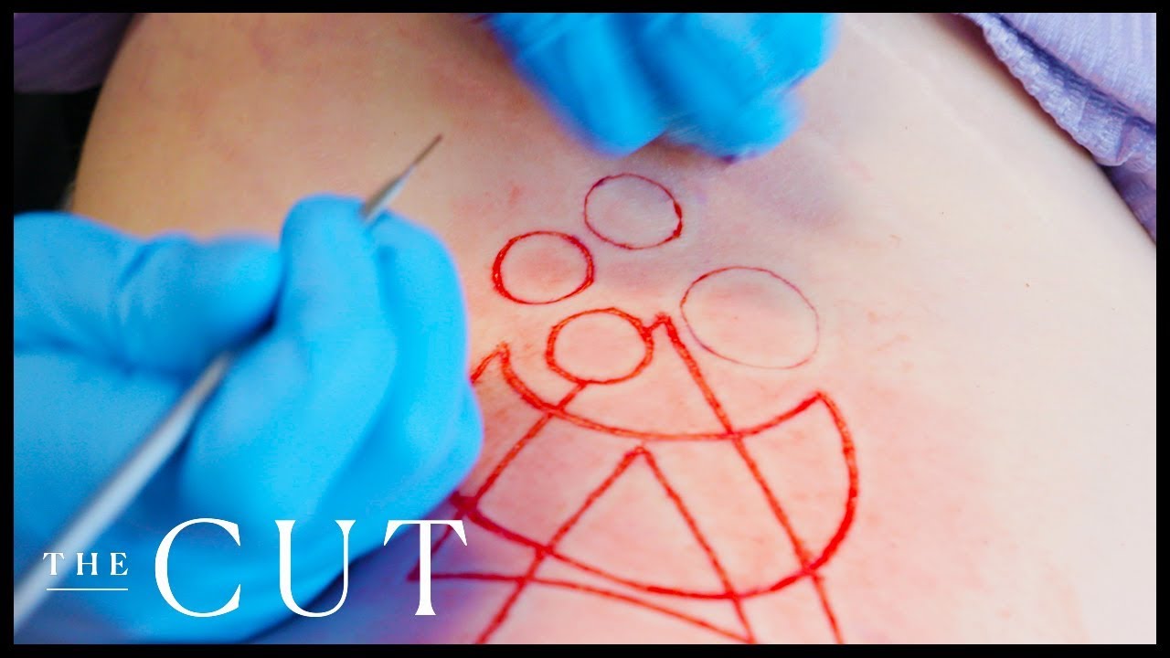Radical Beauty: Cutting Skin-Deep With a Scar Artist