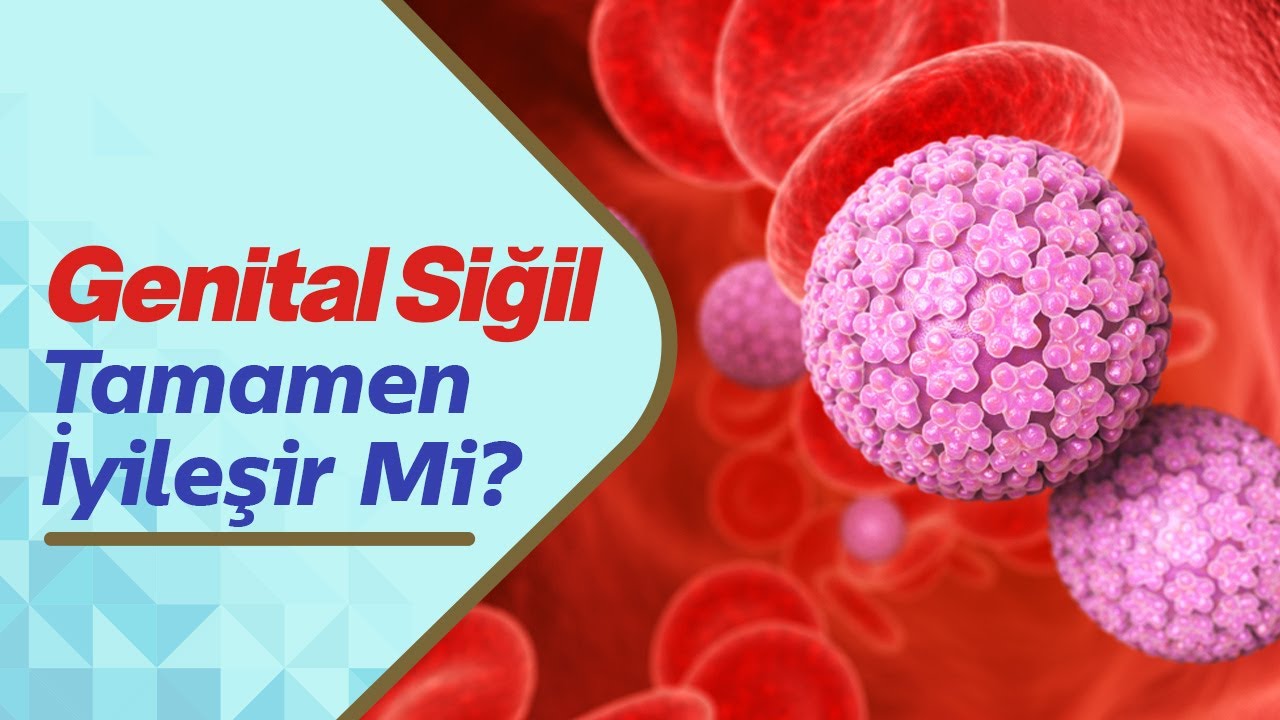 Erkeklerde Genital Siğil Belirtileri Nelerdir? Genital Siğil Tamamen İyileşir mi?