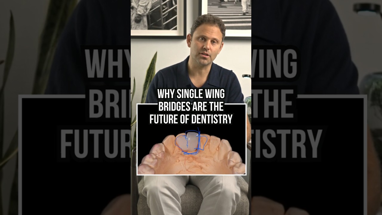 Why Single Wing Bridges Are the Future of Dentistry!