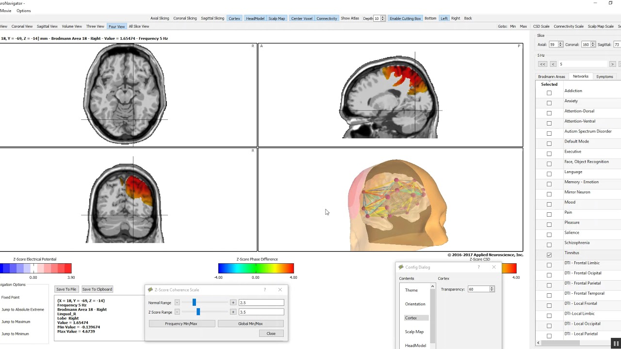 NeuroNavigator Functional  Connectivity - Explore the Brain