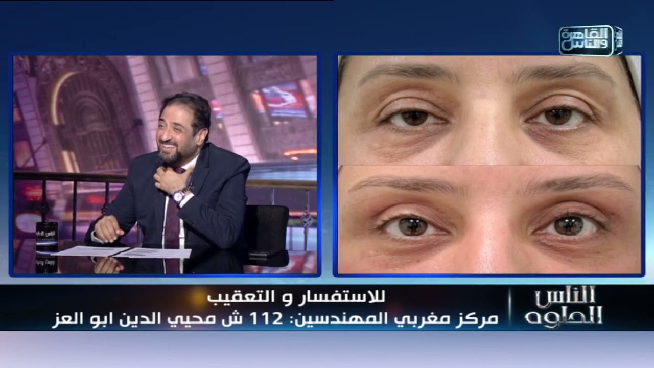 الناس الحلوة | اللمسات الفنية فى عالم تجميل الجفون مع دكتور معتز دعبيس