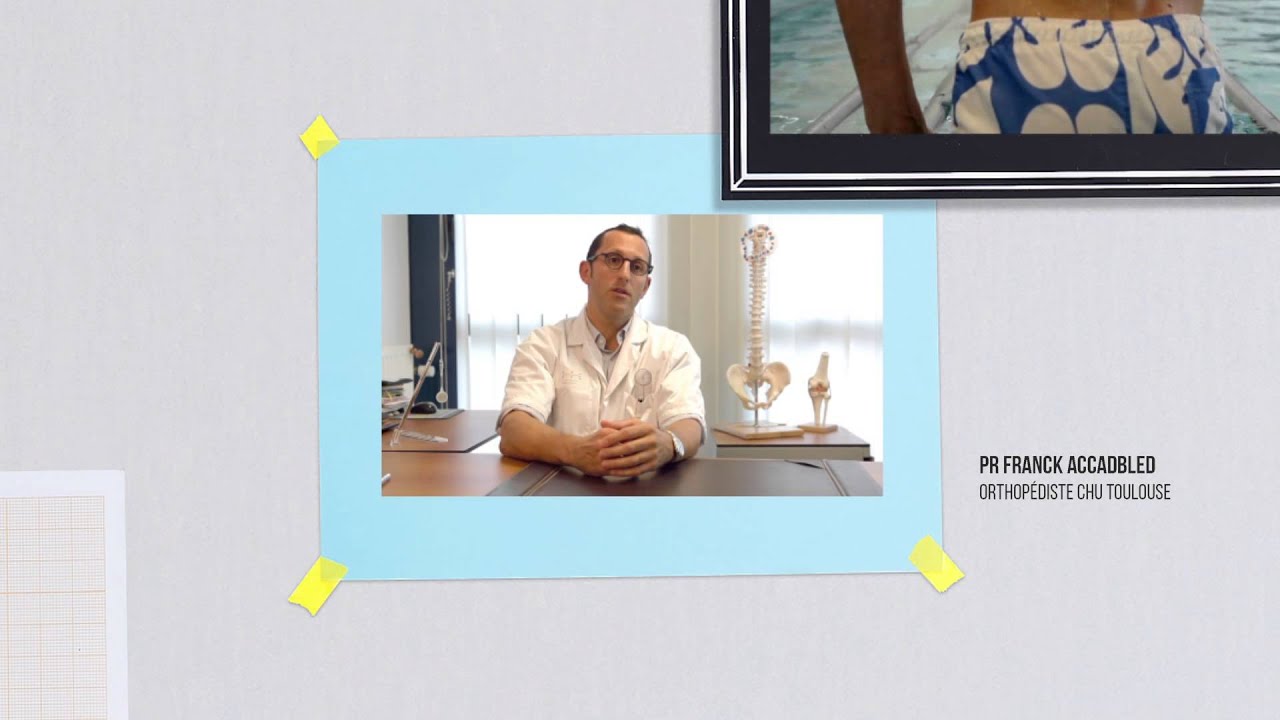 L'algodystrophie ou Syndrome Douloureux Régional Complexe - Film destiné aux professionnels de santé