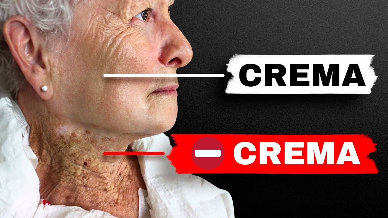 Lifting facciale NATURALE. A 65 anni le rughe scompaiono con questi semplici segreti!