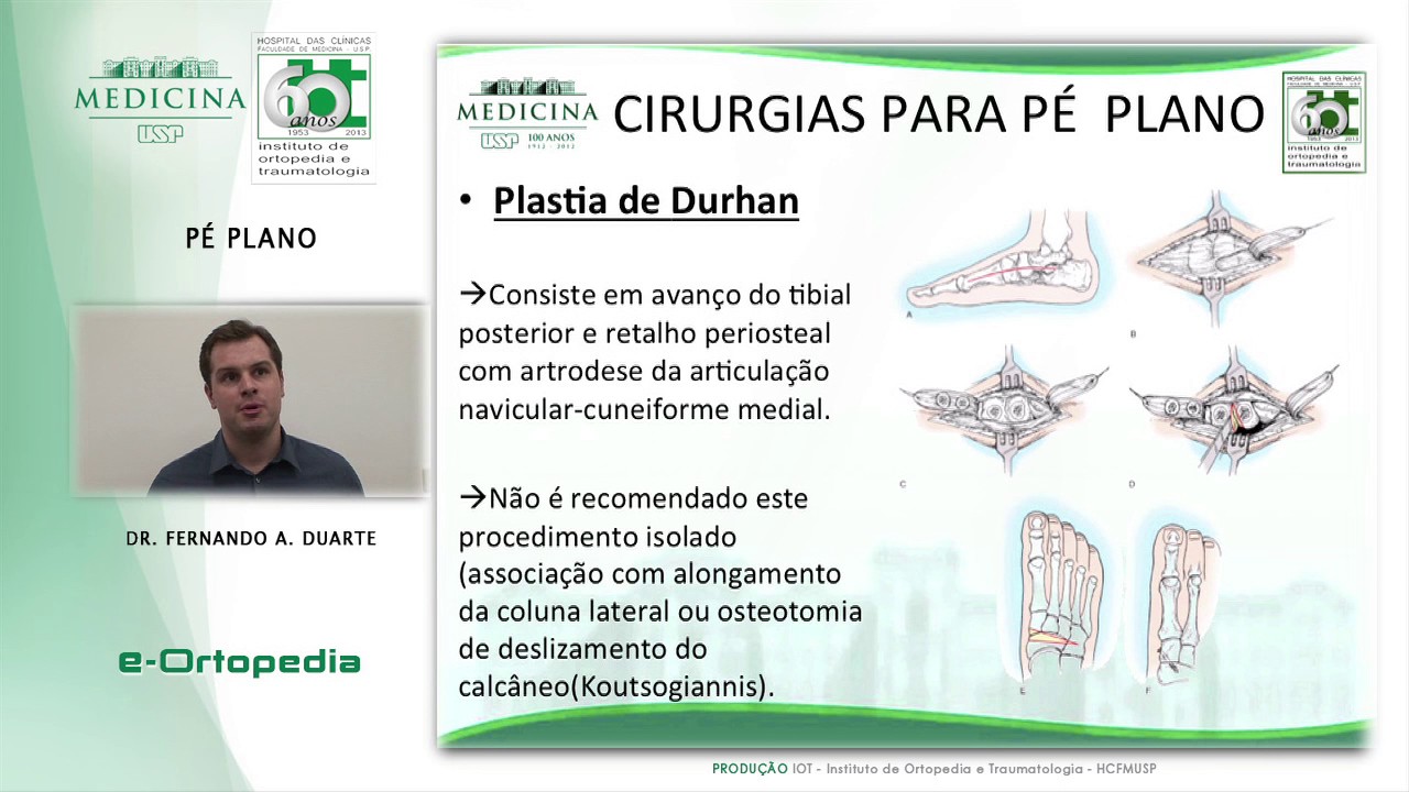 Pé Plano - Dr. Fernando A. Duarte
