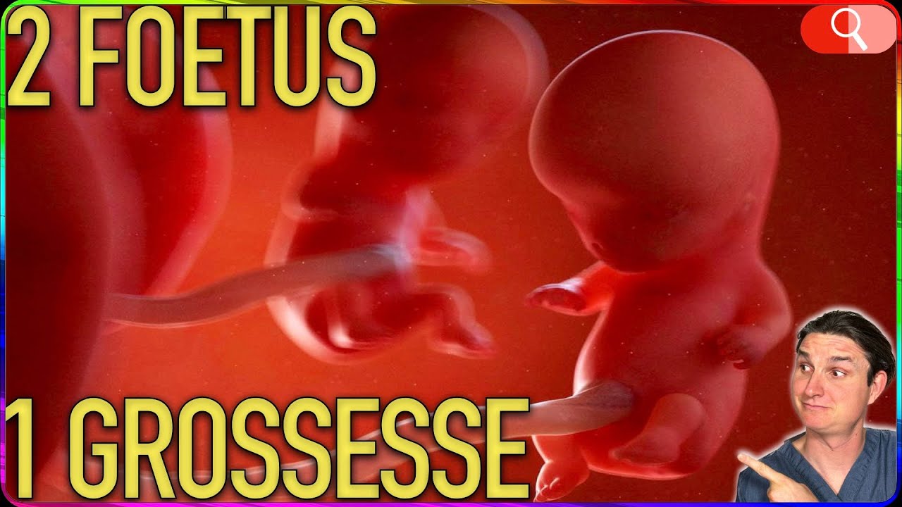 ÉVOLUTION foetus JUMEAUX - Enceint.e jumeaux