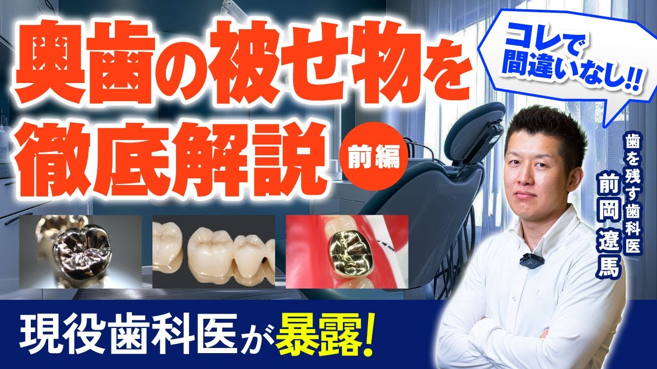 【もう迷わない！奥歯の被せ物をプロ目線で徹底解説】