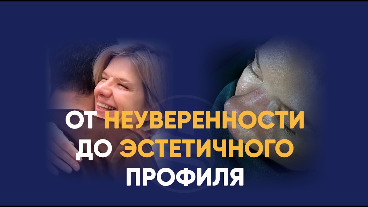 Хирургическое сужение носа | Результаты ринопластики