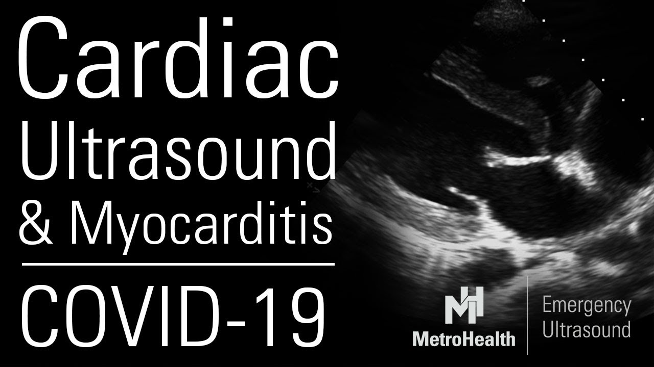 COVID & Myocarditis