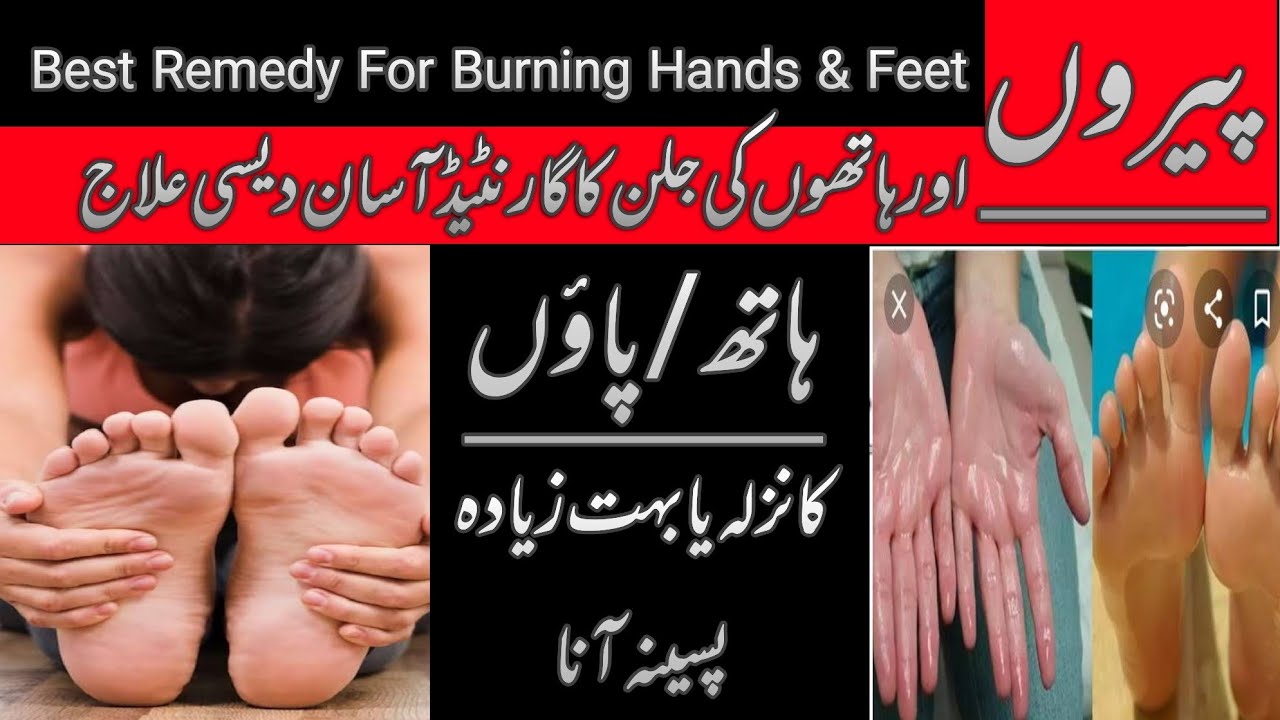 Say Goodbye to Excessive Sweating! 💦 Natural Remedies to Stop Hand and Foot Sweat by Dr Asim