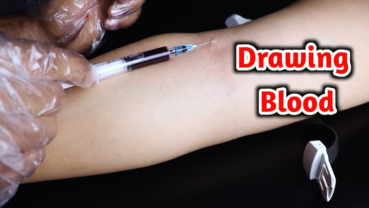 تعلم سحب الدم من المرة الاولي(تعليم سحب الدم للمبتدأين)_Teaching beginners to draw blood