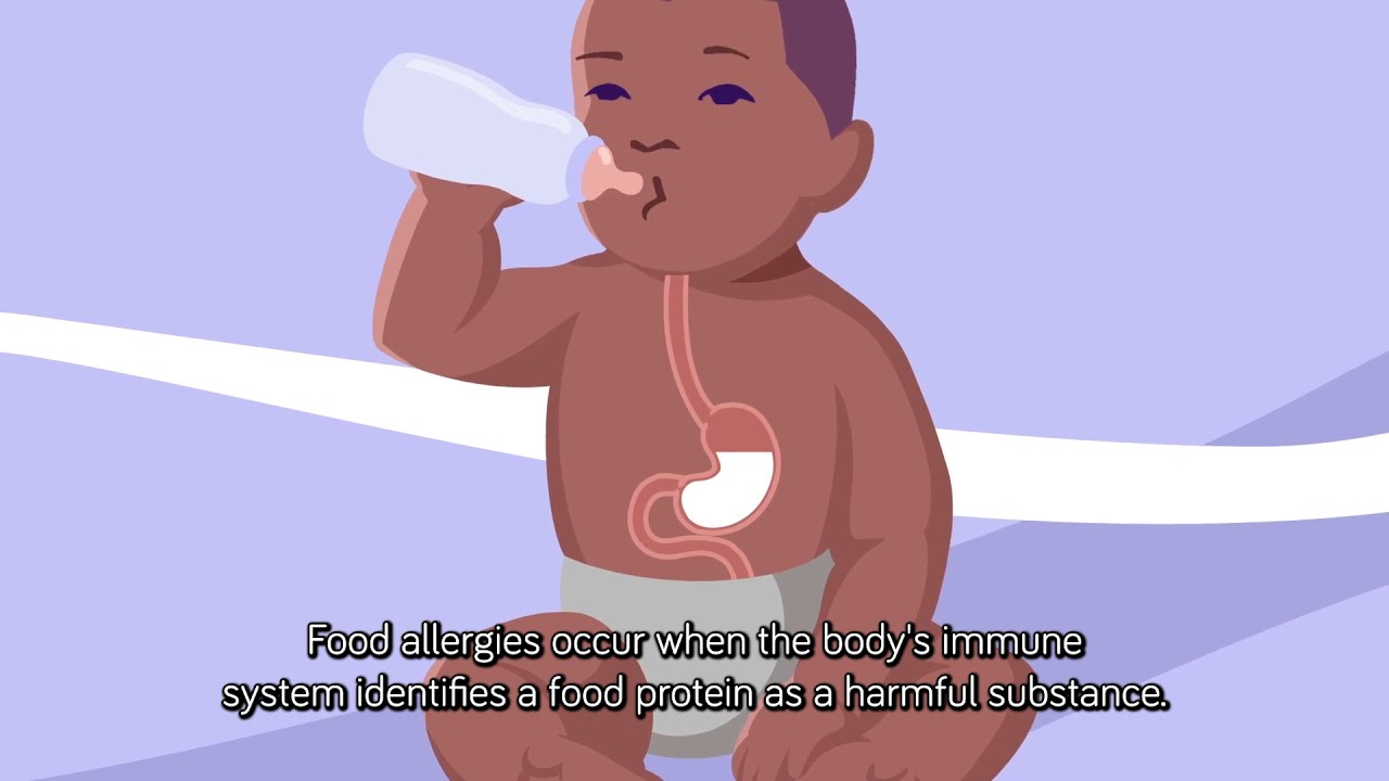 What is Cow Milk Allergy (CMA)?