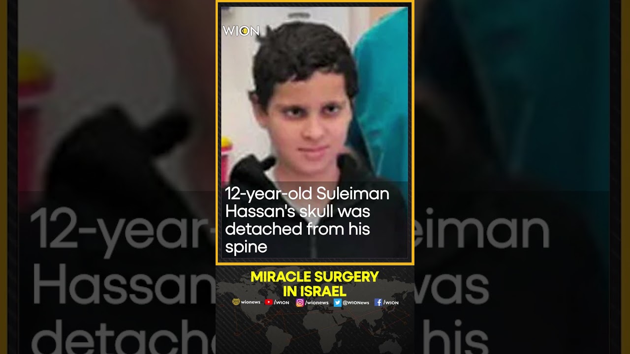 Israeli doctors attach a boy's head in a miracle 12-hour surgery