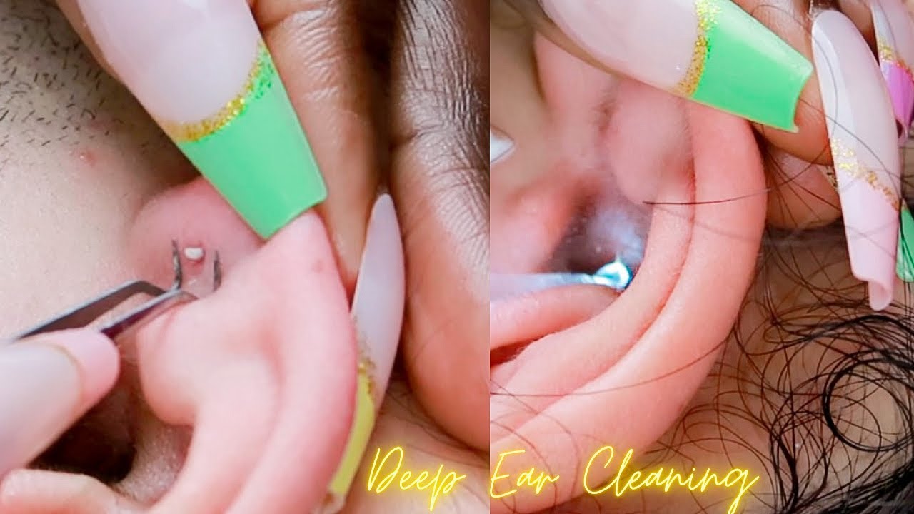 ASMR| Rare Deep Ear Cleaning & Picking ALL-ZOOMED ~ soft whispers 😴
