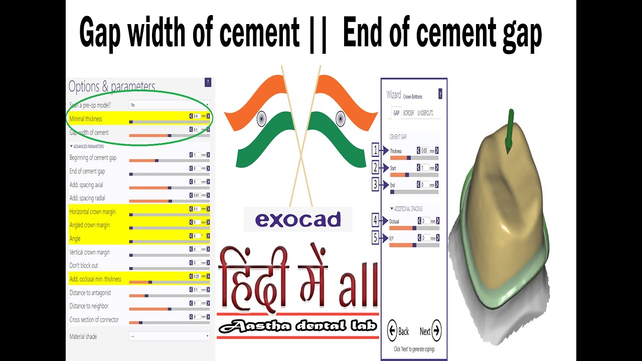 Gap width of cement exocard ||  End of cement gap ||  exocad crown design || crown bottom exocad