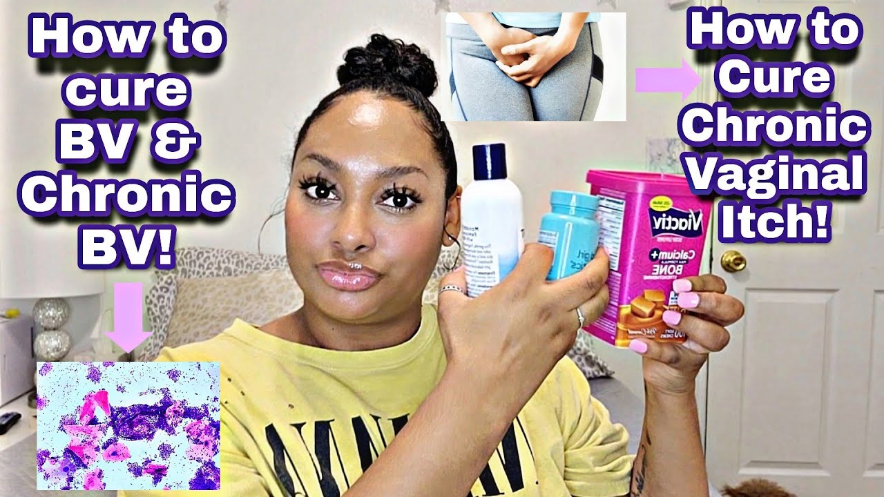 ♡How To Cure BV & Chronic BV!/How To Cure Chronic Vaginal Itch!♡|2022