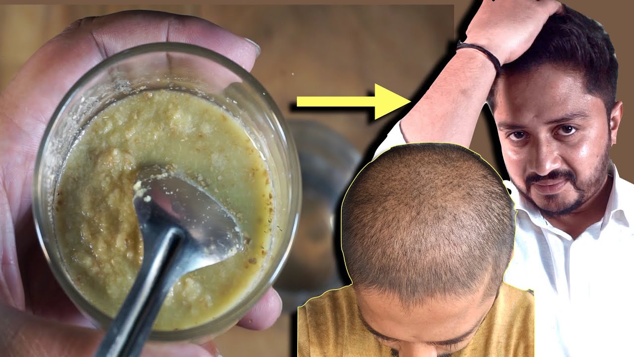 क्या Ginger Juice से Hair Fall बंद होता है? क्या Ginger Juice से नए बाल उगते है? Genuine Tips
