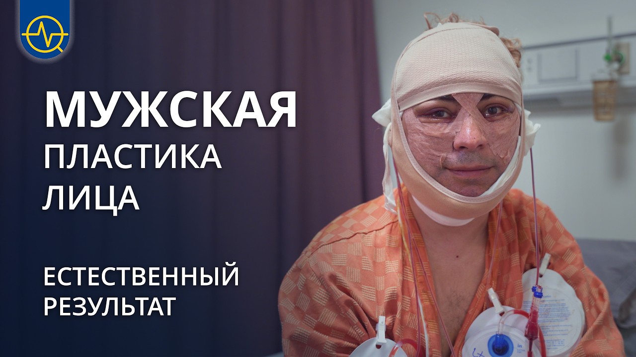 Мужской фейслифтинг в Южной Корее | Комплексный Deep Plane лифтинг лица