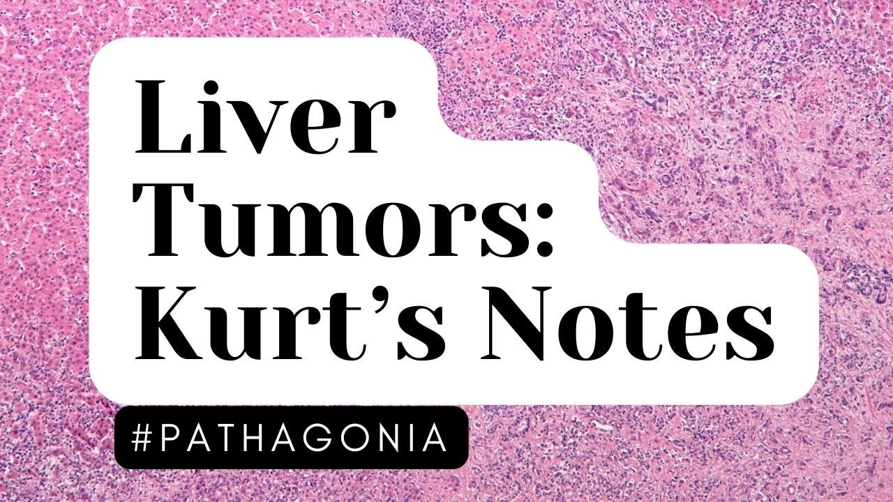 Liver Tumors: Kurt’s Notes #pathagonia