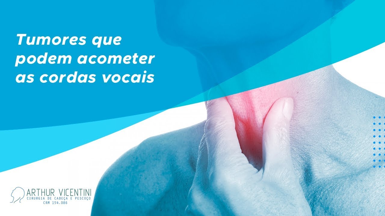 Tumores que podem acometer as cordas vocais | Dr. Arthur Vicentini CRM 154.086