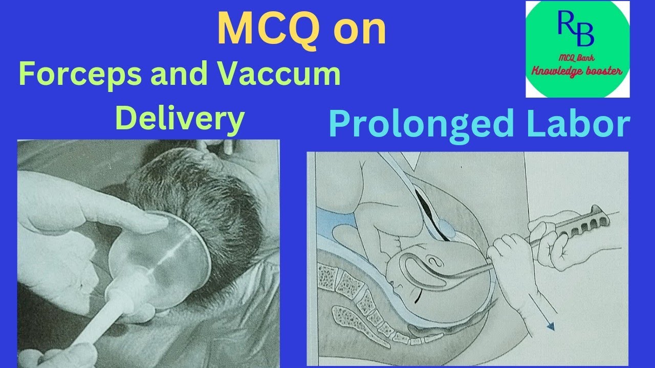 MCQ on Forceps delivery