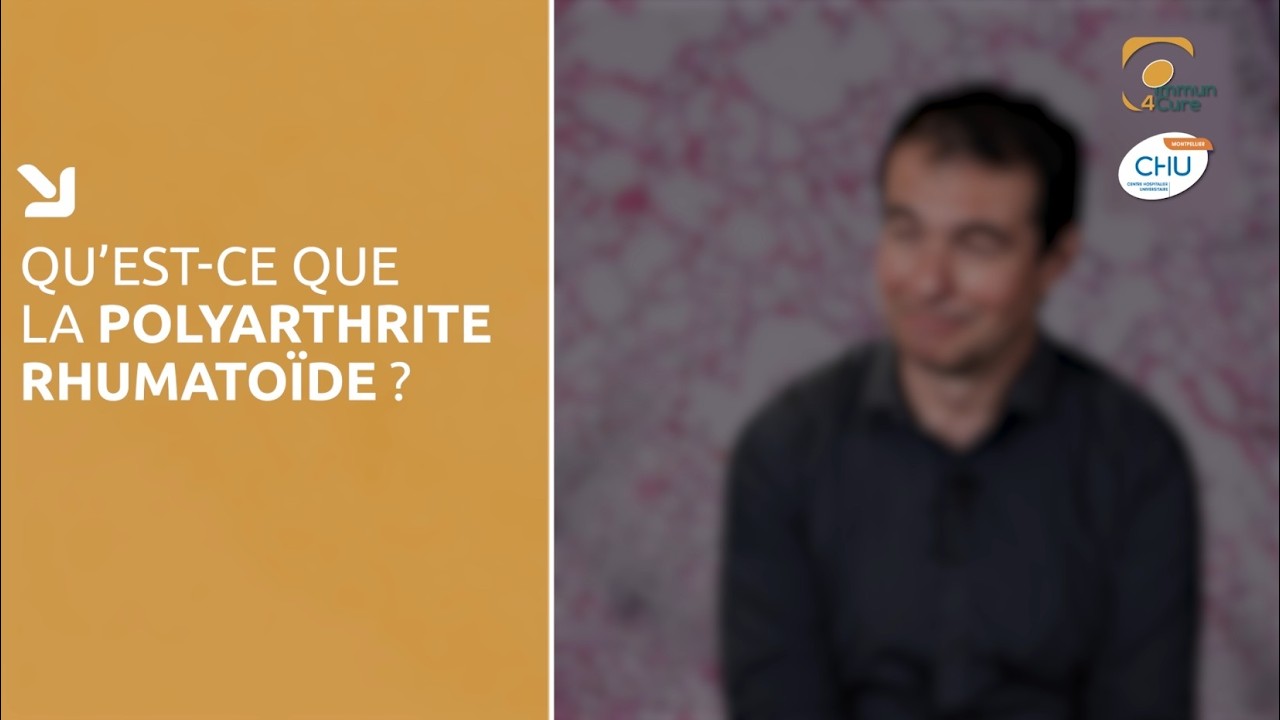 La polyarthrite rhumatoïde _ Immun4cure
