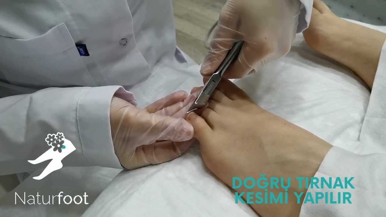 PERİYODİK AYAK BAKIMI-PEDİK&Uuml;R-PEDİCURE-FOOT CARE-FUSSPFLEGE-PEDIK&Uuml;RE-