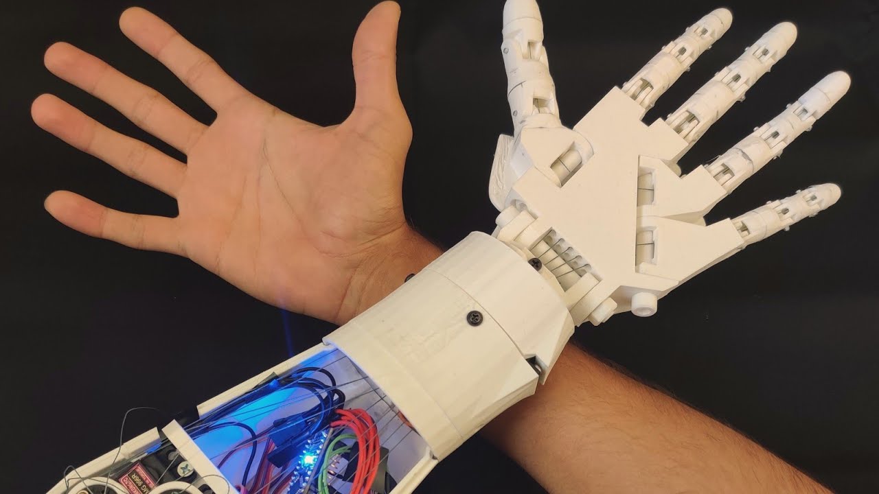 3D Printed EMG Prosthetic Hand