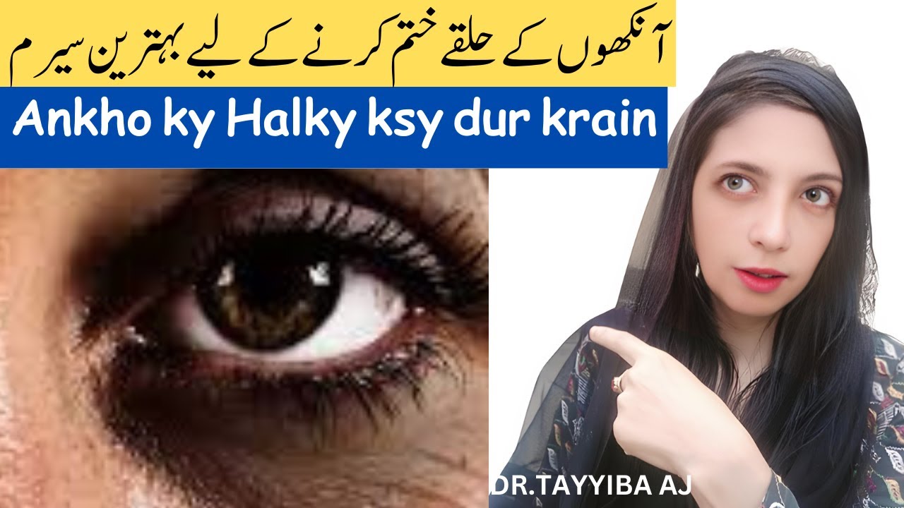Aankhon ke Halke Khatam karne ka asan tarika | Ankhon k Halke dur krny k lea best serum