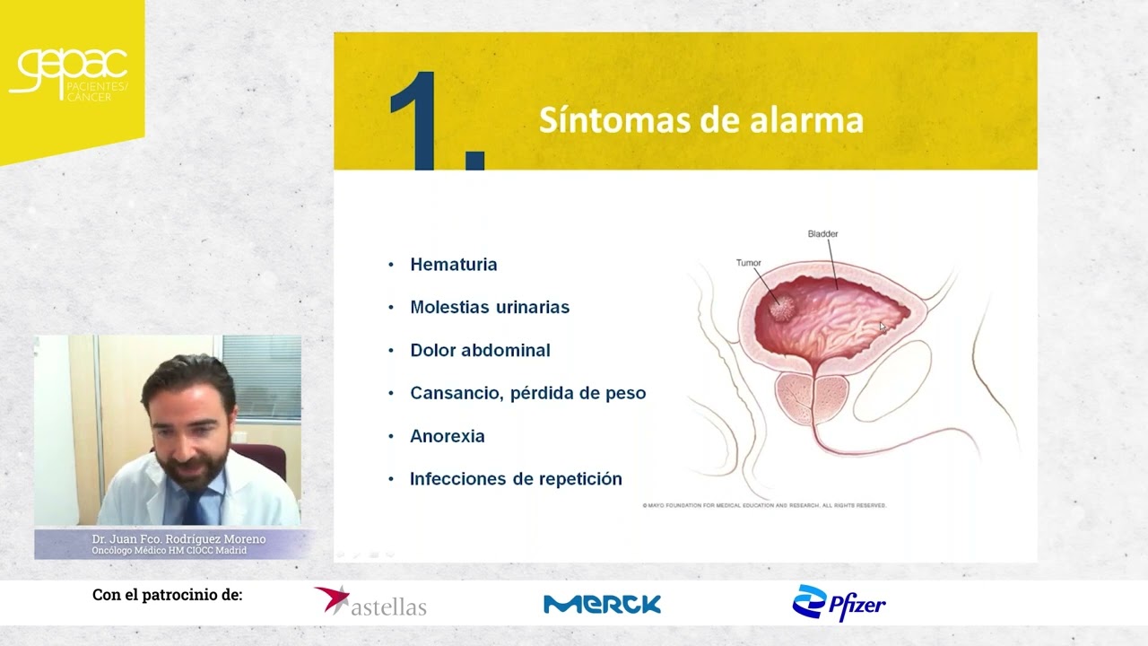 Sintomatología y abordaje del cáncer de vejiga