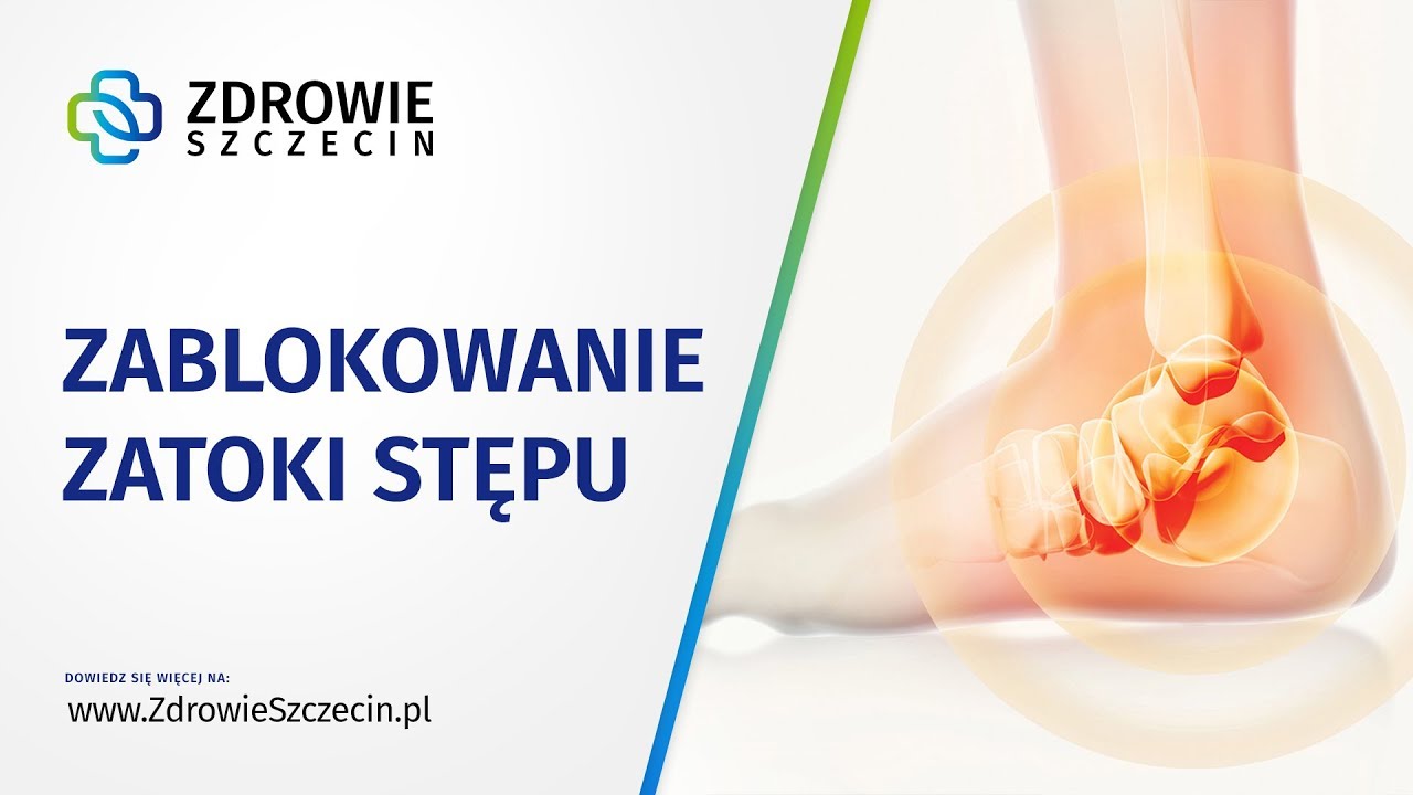 Zablokowanie zatoki stępu - Zdrowie Szczecin