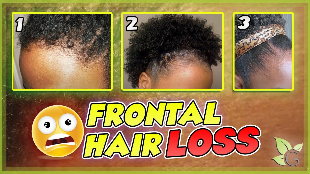 Grow your Edges Back! - The 3 Stages of Progression