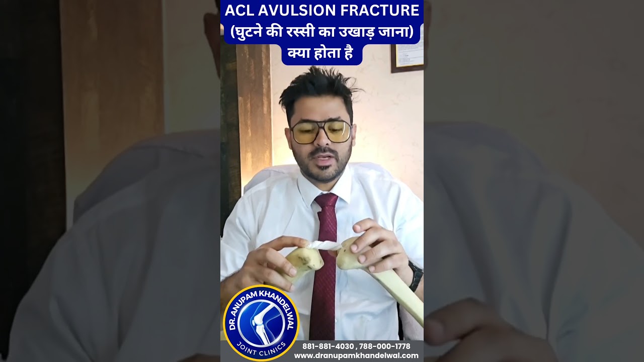 #ACL Avulsion Fracture क्या होता है-#dranupamkhandelwal  #jointsClinic +91-8818814030,+91-7880001778