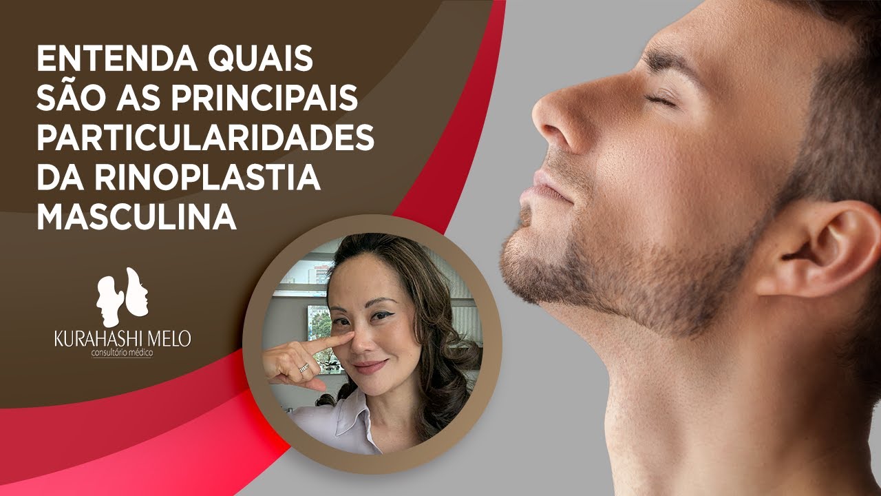 Rinoplastia Masculina: como deixar o nariz mais harmônico e natural