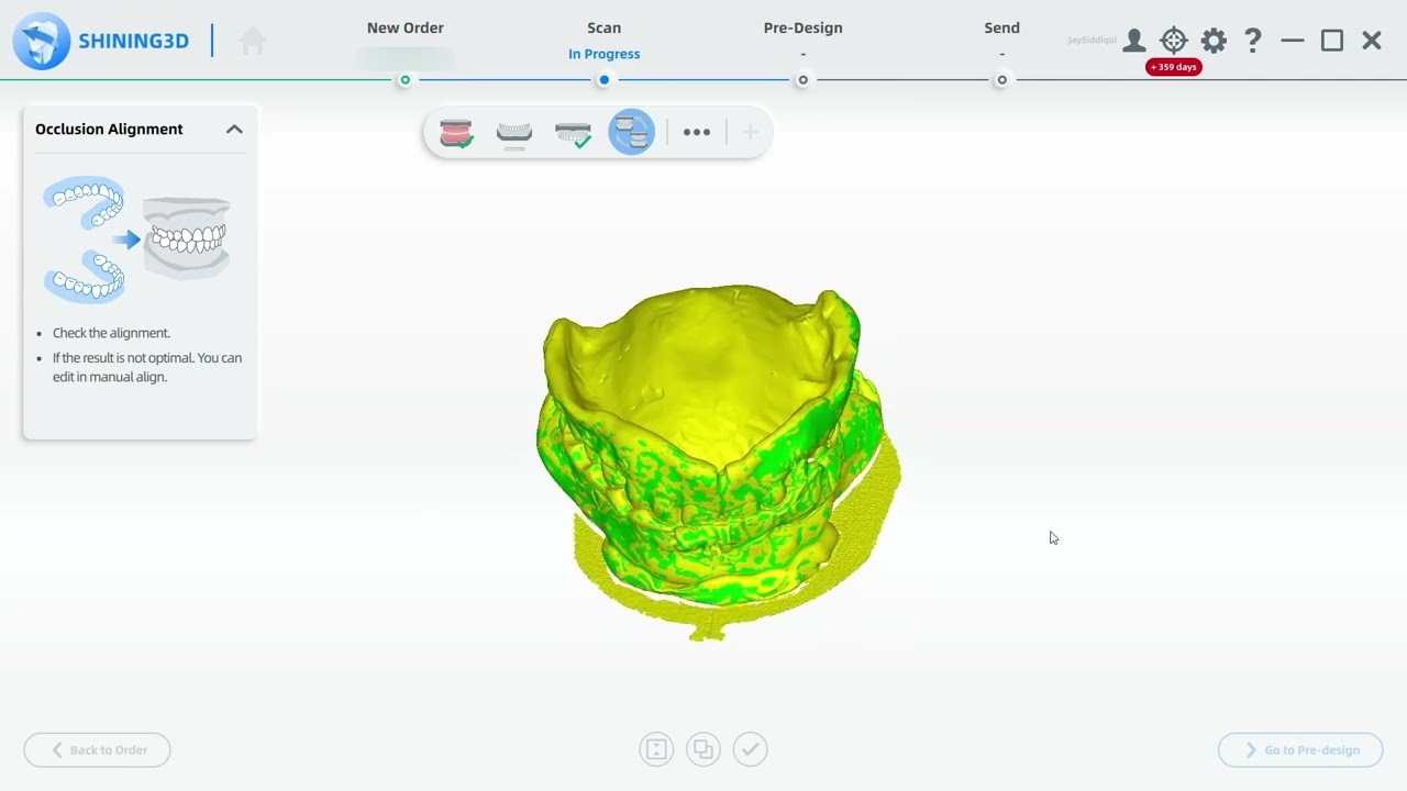 Desktop vs Intraoral Scanners: Medit i900 vs Trios 5 vs Shining DS-EX Pro (Bite rim scan)