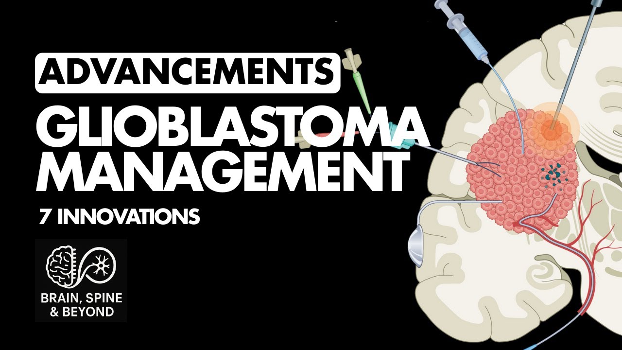 Glioblastoma Management - Research Evidence for Latest Advances - How to Make Decisions?