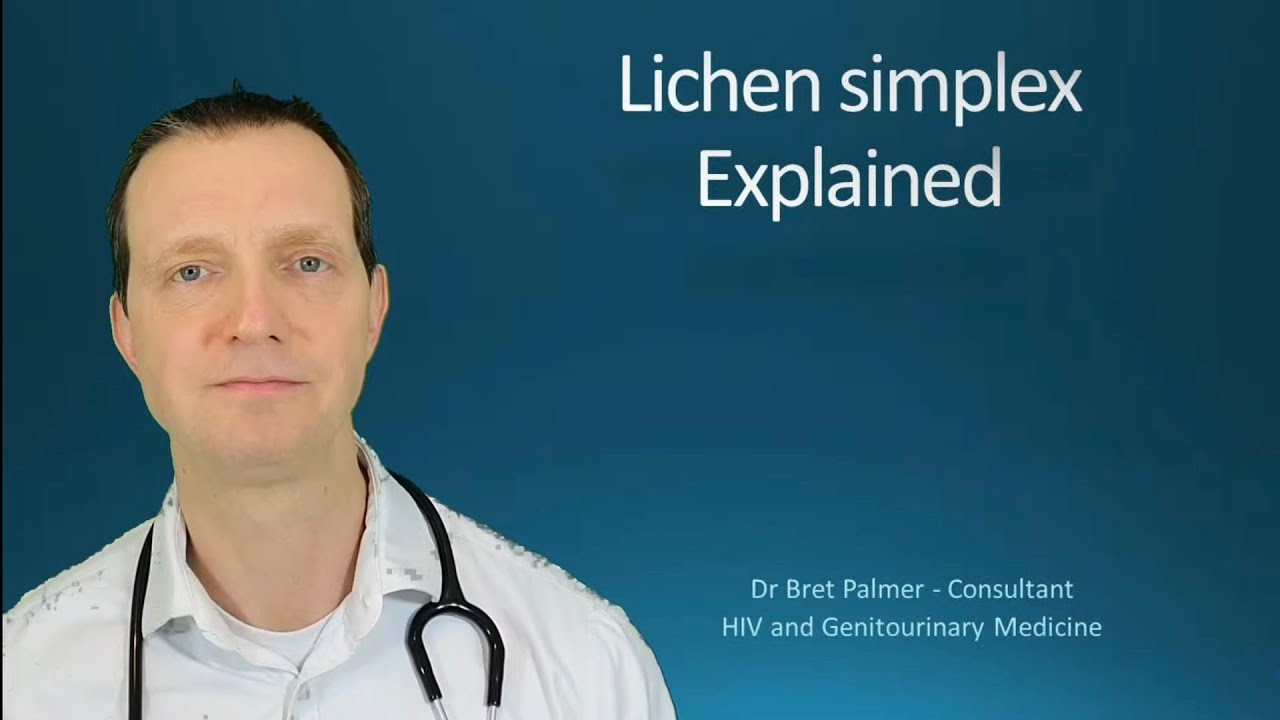 Lichen Simplex Explained #51