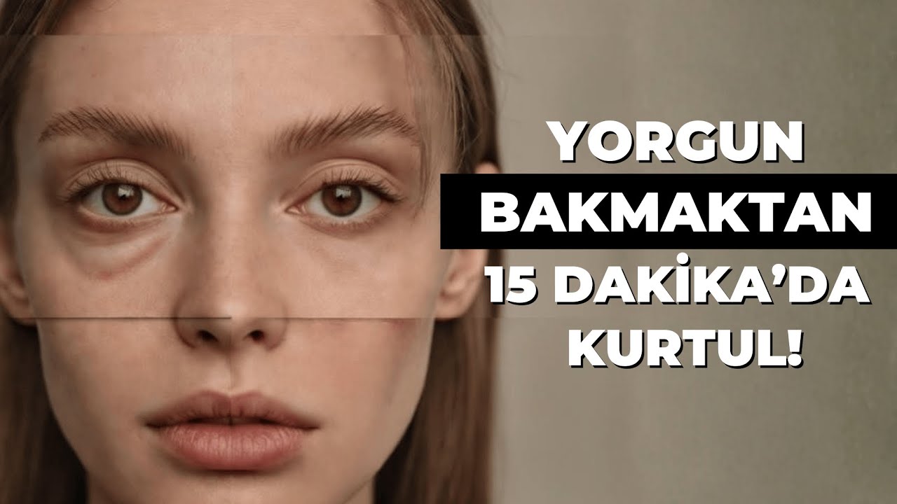 Ameliyatsız G&ouml;z &Ccedil;evresi Gen&ccedil;leştirme: SmoothEye Lazer Tedavisi