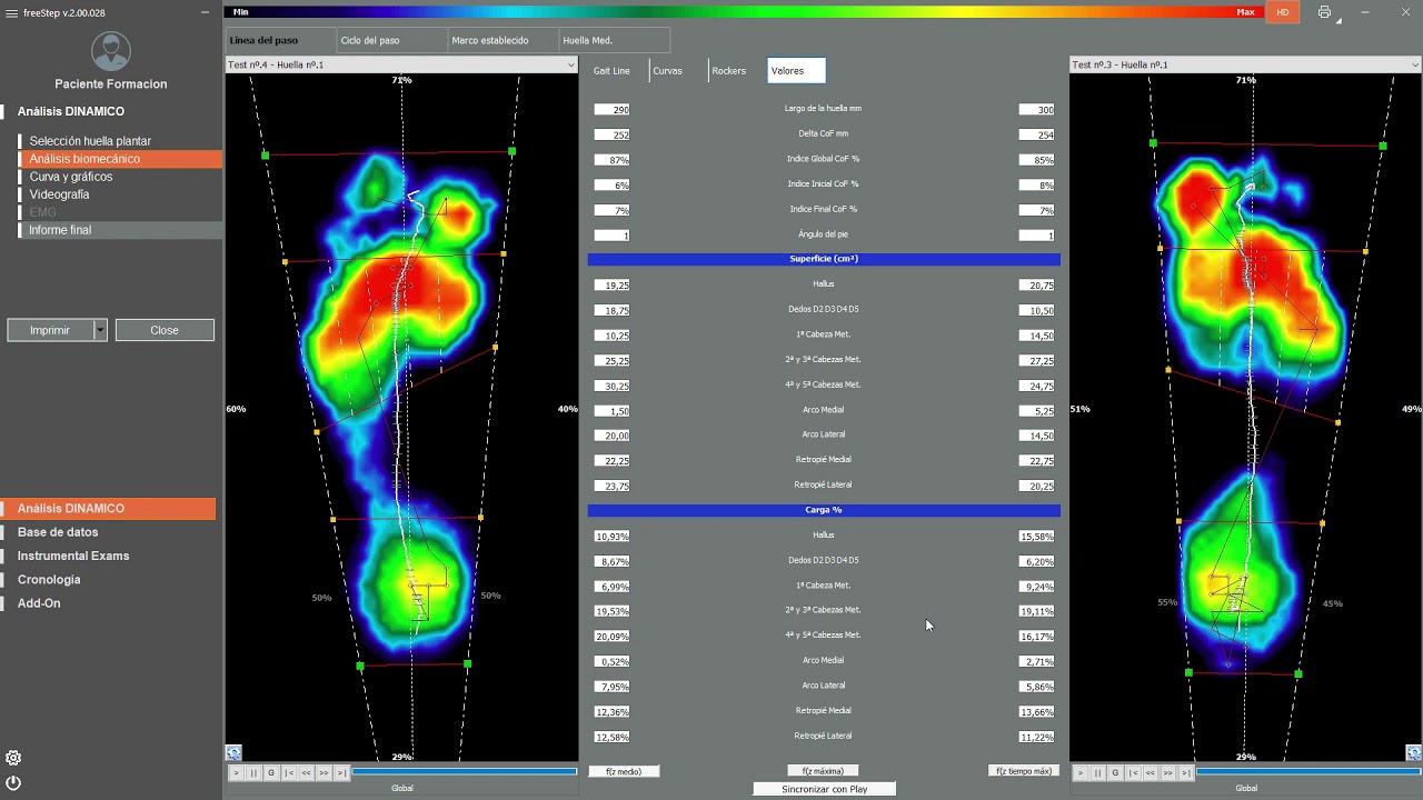 Datos MUY importantes en estudios de estática y dinámica con FreeStep 2.0