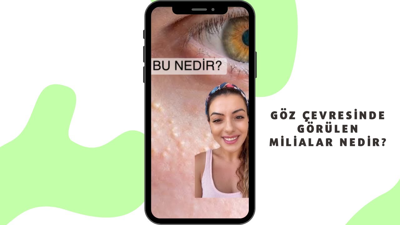 G&ouml;z &ccedil;evresinde ve y&uuml;zde g&ouml;r&uuml;len milialar nedir? - Do&ccedil;. Dr. Ezgi &Ouml;zkur #shorts